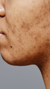 Non-surgical jowl treatments at It’s Me and You Clinic in London, Kingston upon Thames and Surrey – jawline contouring, dermal fillers and skin tightening to lift and define sagging jowls.