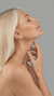 Weak jawline treatment at It’s Me and You Clinic in London, Kingston upon Thames and Surrey using jawline fillers, contouring injections and non-surgical jaw enhancement.