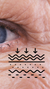 Treatment for wrinkly skin at It’s Me and You Clinic in London, Kingston upon Thames and Surrey – Botox, dermal fillers and collagen-boosting procedures to smooth ageing skin.