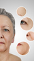 Wrinkly hands treatment at It’s Me and You Clinic in London, Kingston upon Thames and Surrey – Radiesse and Restylane fillers to restore volume and smooth ageing hands.