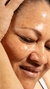 Age spots and cheek spots removal treatment – It’s Me & You Clinic Kingston upon Thames, Surrey, London