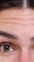Forehead wrinkles treatment at It’s Me and You Clinic in London, Kingston upon Thames and Surrey – Botox injections, skin boosters and anti-wrinkle treatments to smooth forehead lines and prevent deep creases.