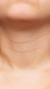 Neck lines treatment at It’s Me and You Clinic in London, Kingston upon Thames and Surrey – Botox, skin boosters, and microneedling for horizontal neck lines and ageing skin.