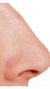 Misshapen nose treatment at It’s Me and You Clinic in London, Kingston upon Thames and Surrey – non-surgical rhinoplasty with dermal fillers to reshape and straighten the nose without surgery.
