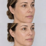 Illustrative Jalupro Super Hydro before and after comparison showing smoother texture, improved hydration and firmer, more refreshed-looking facial skin.