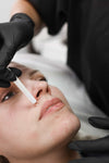 Nose to mouth lines treatment at It’s Me and You Clinic in London, Kingston upon Thames and Surrey – dermal fillers for nasolabial folds, smile line reduction and facial rejuvenation.