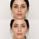Illustrative NCTF before and after image showing smoother texture, improved hydration and a brighter, more even-looking facial complexion.