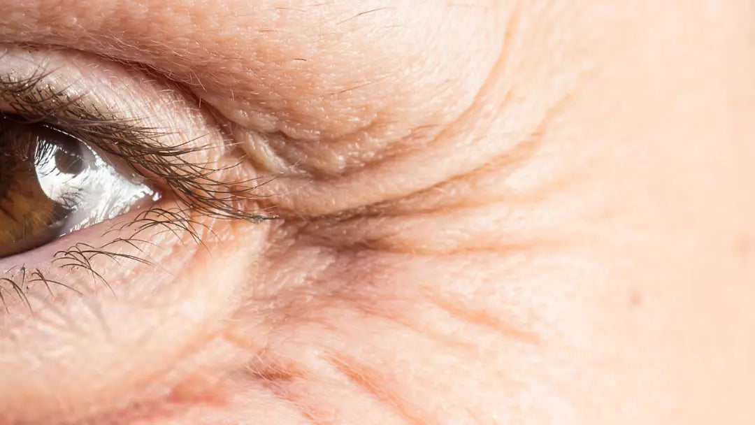 Botox by Age