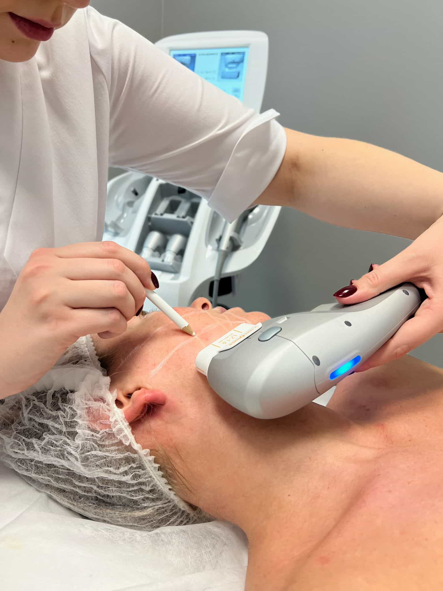 Jawline filler treatment at It’s Me and You Clinic in London, Kingston upon Thames and Surrey – dermal fillers to enhance jawline definition and contour.