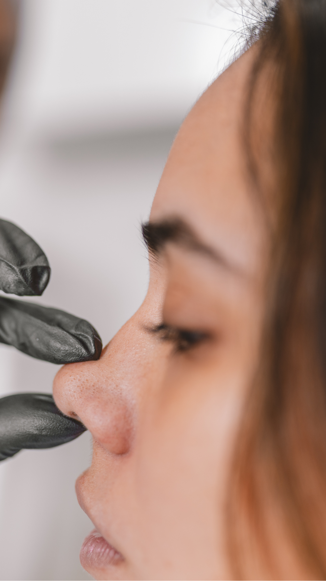 Misshapen nose treatment at It’s Me and You Clinic in London, Kingston upon Thames and Surrey – non-surgical rhinoplasty using dermal fillers to correct bumps, asymmetry and nose shape.