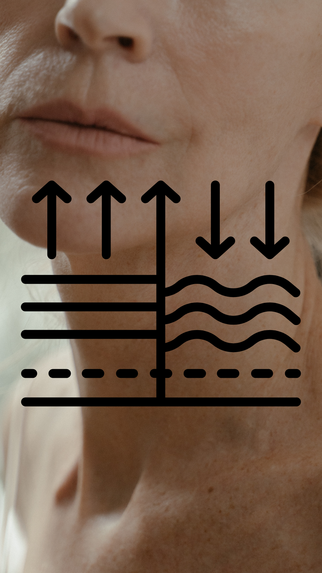 Wrinkly neck treatment with neck lift and anti-wrinkle solutions – It’s Me & You Clinic Kingston upon Thames, Surrey, London