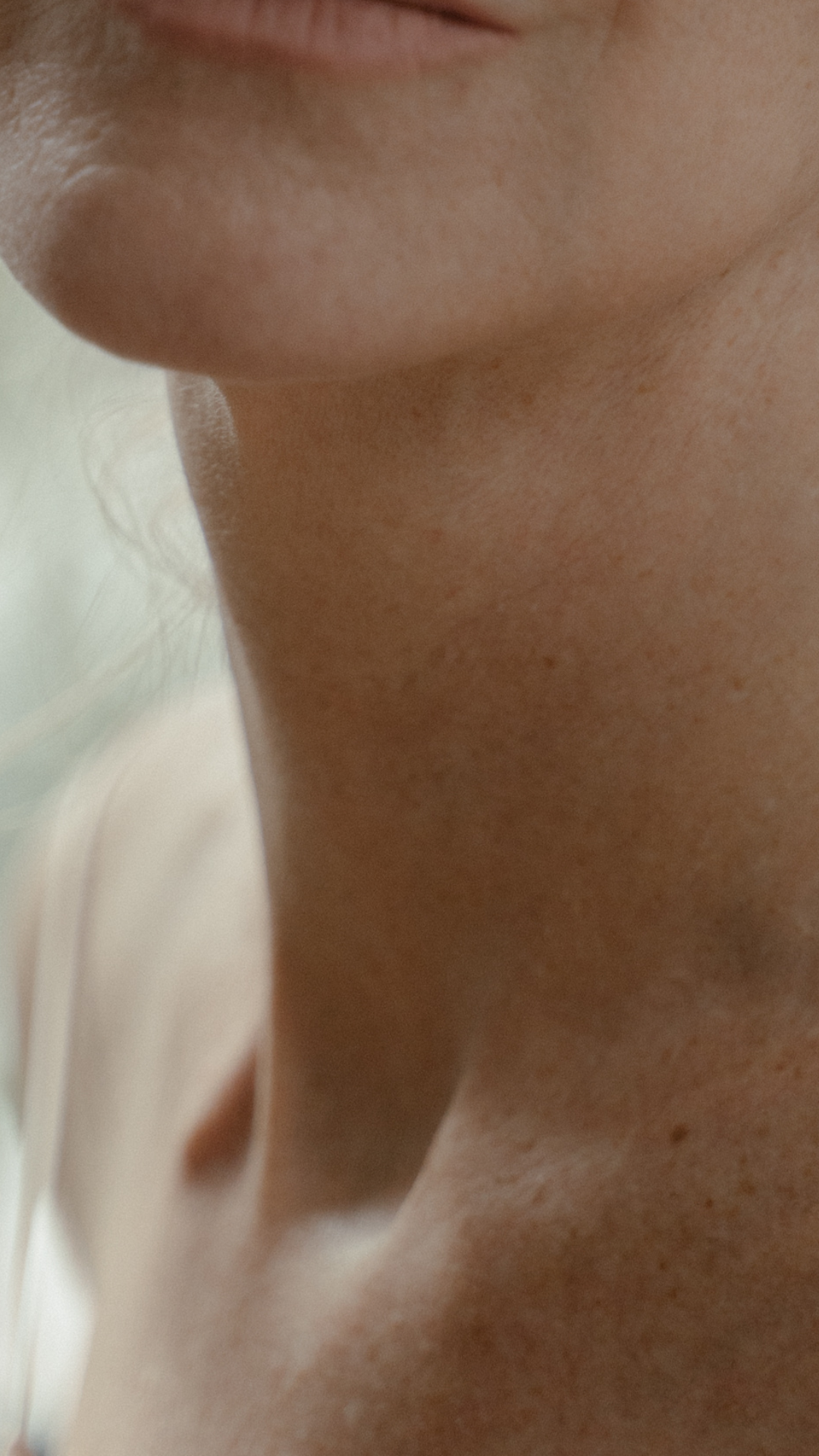 Wrinkles on chest treatment at It’s Me and You Clinic in London, Kingston upon Thames and Surrey – chest wrinkle reduction using skin boosters, microneedling and anti-wrinkle injections.