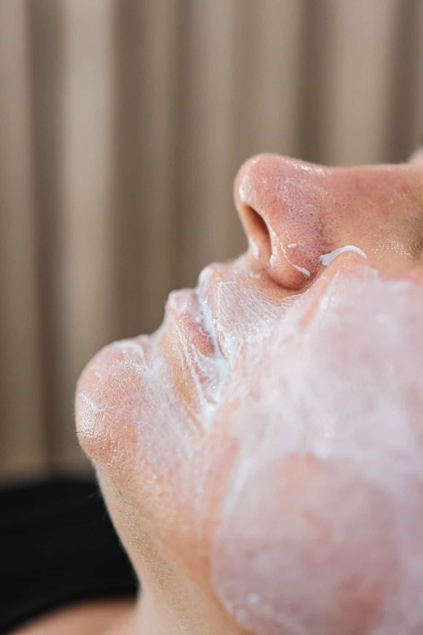 Skin Pen Microneedling - Kingston Upon Thames, Surrey, London – It's Me & You