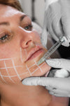 Juvederm Volite skin booster treatment at It’s Me and You Clinic in Kingston upon Thames, Surrey – hydrating and radiance-boosting injectable therapy for smoother, glowing skin.