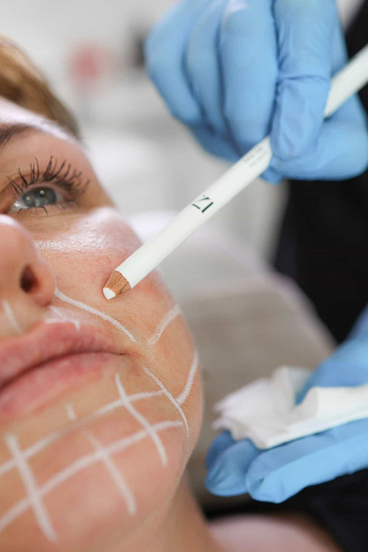 Acne Treatment Options in Frimley, Surrey