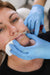 Lip augmentation with dermal filler – before and after at It’s Me & You Clinic Kingston upon Thames, Surrey, London