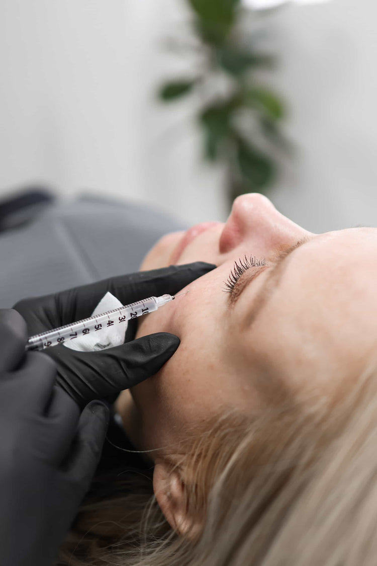 Acne Scar Treatment in Cobham, Surrey