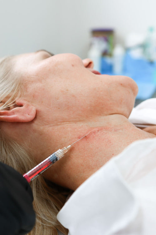 What to Expect During a Botox Consultation in the UK