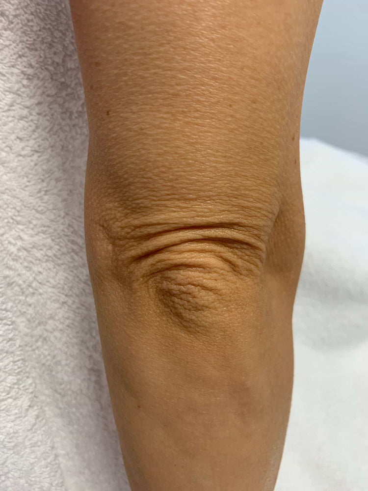 Skin Tone Correction in Gomshall, Surrey
