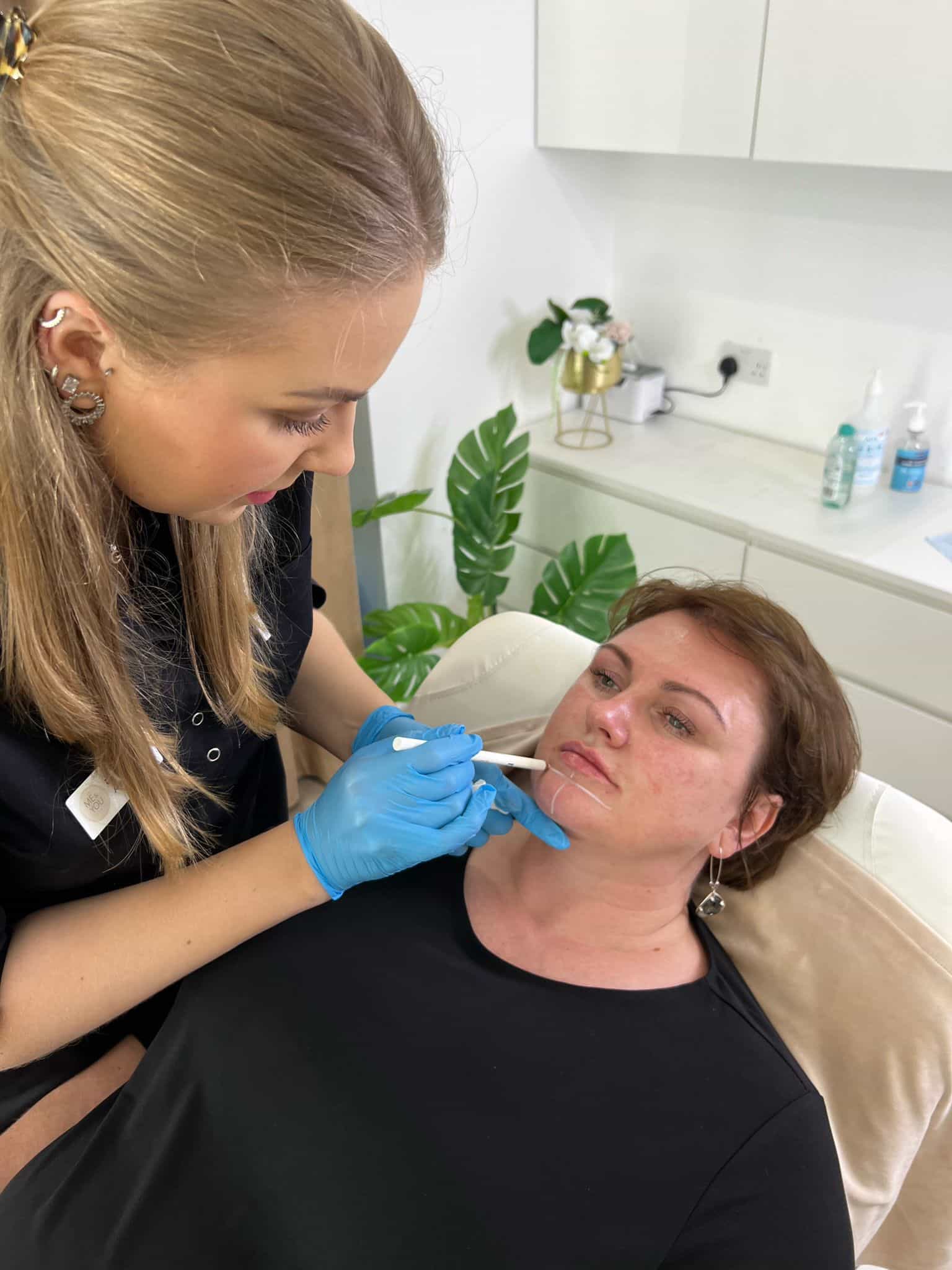 Botox Jaw Slimming (Masseter Reduction) in Richmond, London