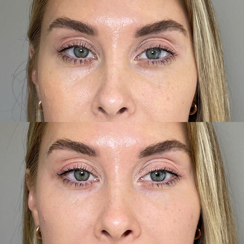 What is the kiss of death retinol?
