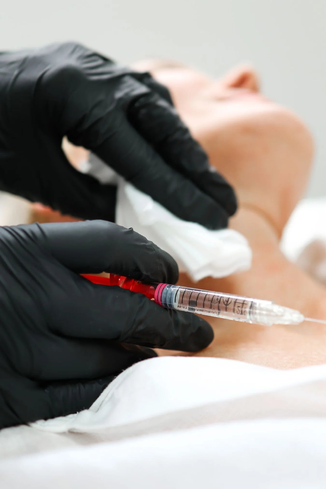 Wrinkles on Chest, Wrinkles Treatment in London & Kingston, Surrey – It's Me & You
