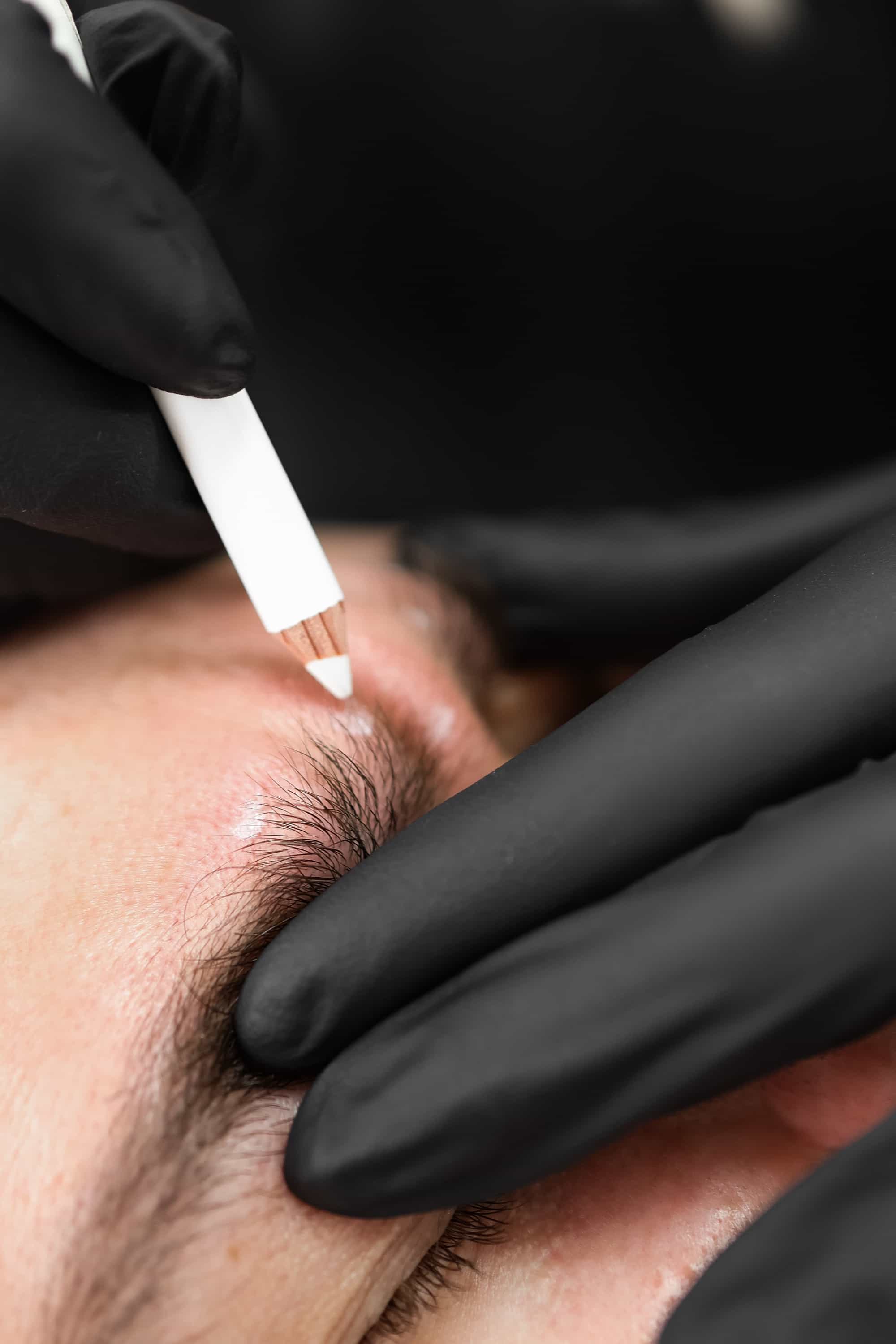 Forehead wrinkles treatment at It’s Me and You Clinic in London, Kingston upon Thames and Surrey – anti-wrinkle injections, Botox and advanced skincare to reduce forehead lines and smooth ageing skin.