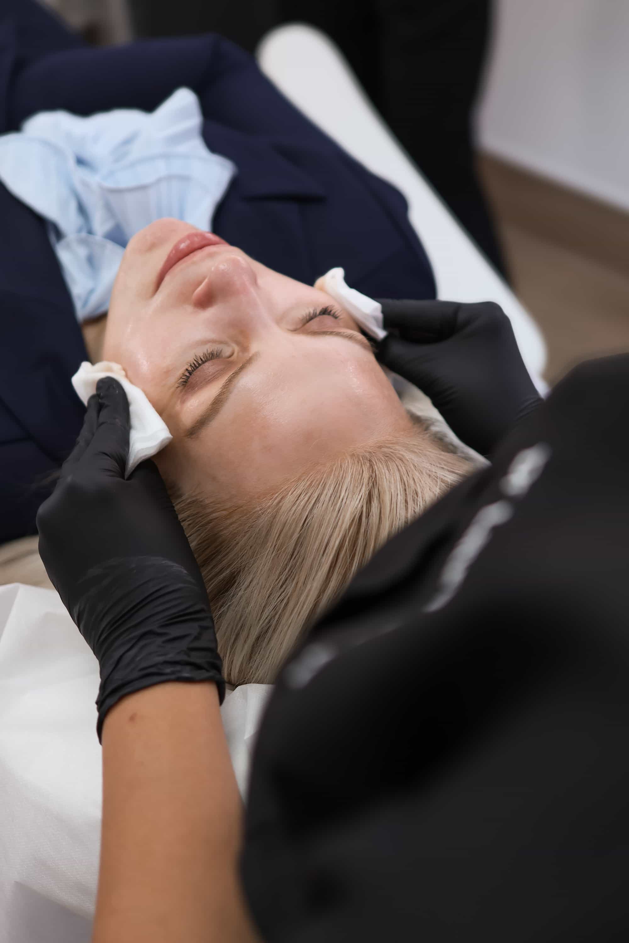 Hyperpigmentation Treatment in London & Kingston, Surrey – It's Me & You