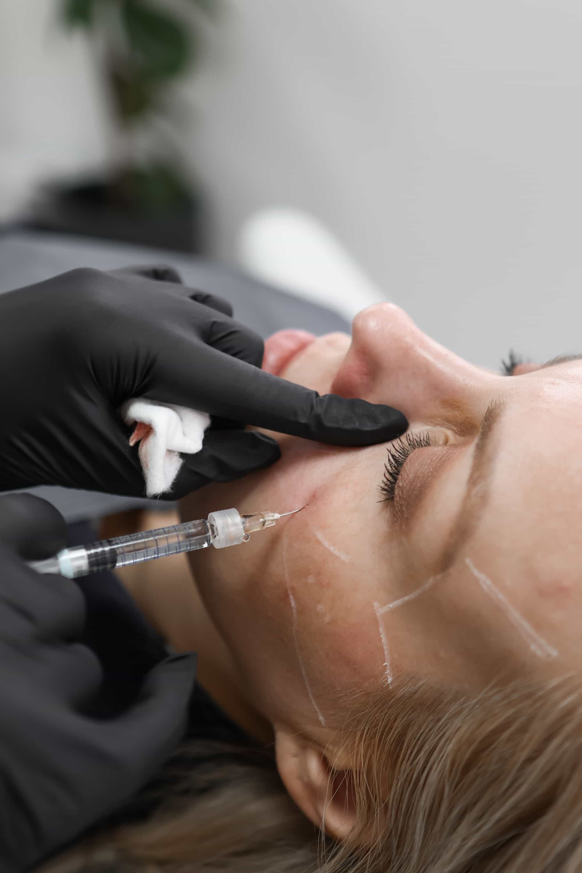 Wrinkles treatment at It’s Me and You Clinic in London, Kingston upon Thames and Surrey – Botox for wrinkles, anti-wrinkle injections, dermal fillers and non-surgical wrinkle removal.