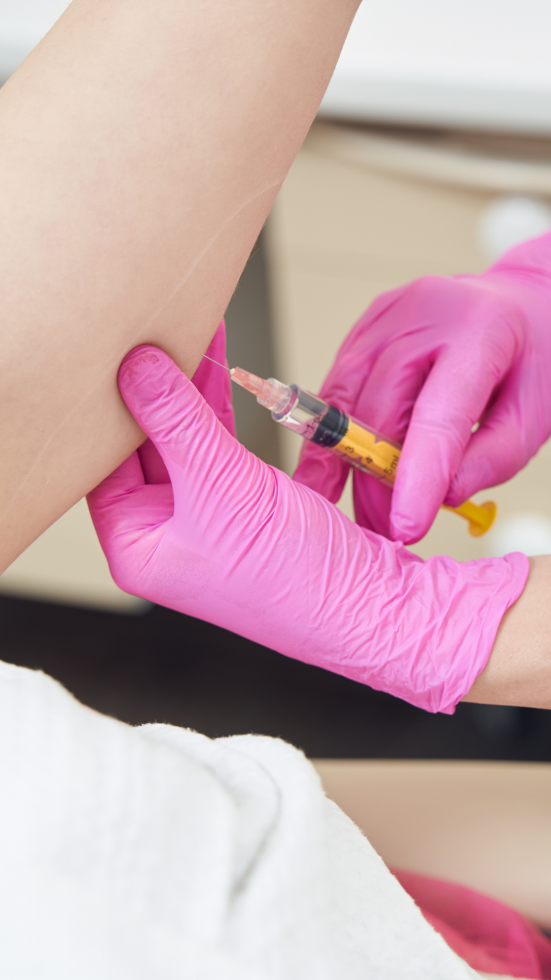 Lose arm fat with CoolSculpting at It’s Me and You Clinic in London, Kingston upon Thames and Surrey – non-surgical fat freezing for upper arm slimming, contouring and stubborn fat reduction.