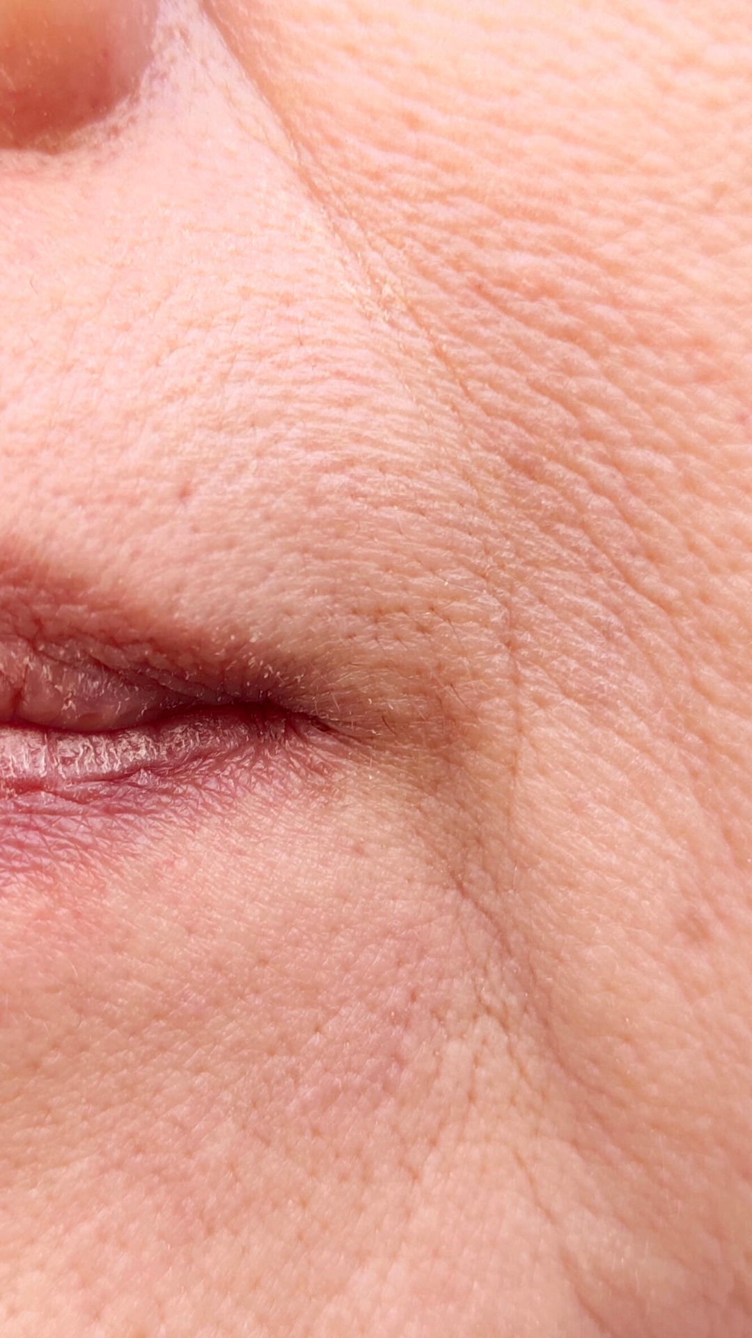 Doctor led aesthetic clinic at It’s Me and You Clinic in Kingston upon Thames, Surrey – expert medical aesthetics, advanced skin treatments and personalised care by experienced doctors.