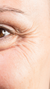 Professional Botox treatments at It’s Me and You Clinic in Kingston upon Thames, Surrey – targeted wrinkle smoothing and facial rejuvenation by expert practitioners.