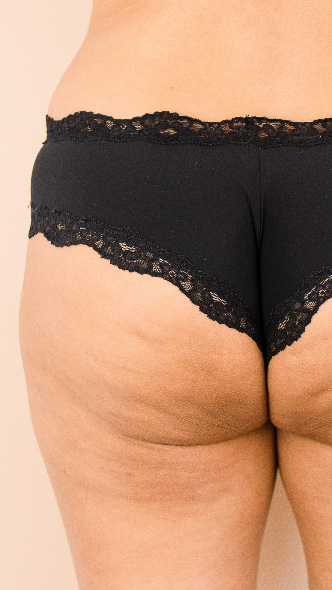 Best Treatment for Hip Dips in London & Kingston, Surrey – It's Me & You