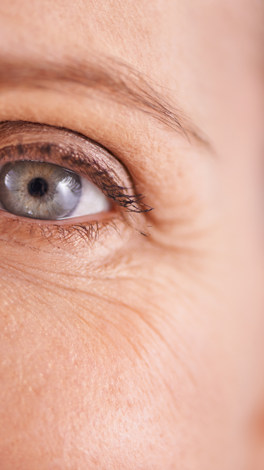 Under eye wrinkles treatment at It’s Me and You Clinic in Kingston upon Thames, Surrey and London – smooth fine lines with advanced dermal fillers, microneedling, and skin tightening solutions.