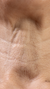 Wrinkly Neck - Neck Lift, Neck Wrinkle Treatment in London & Kingston, – It's Me & You