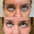 Polynucleotides in Kingston upon Thames, Surrey – Skin Rejuvenation & DNA-Based Repair – It's Me & You