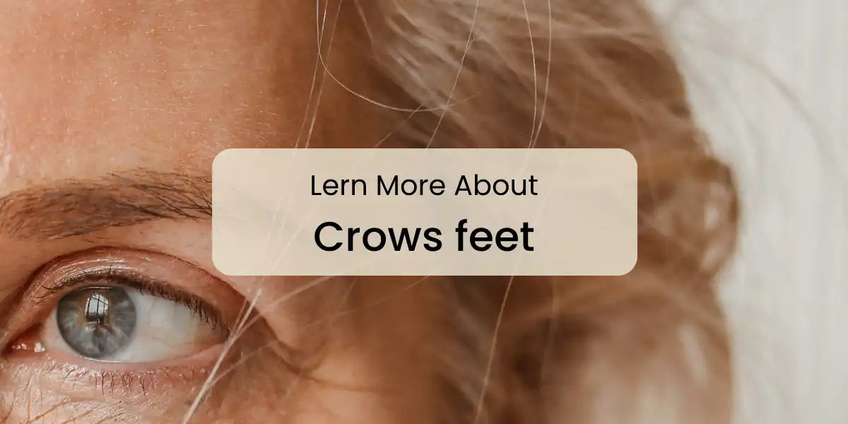 Lern_More_About_Crows_feet