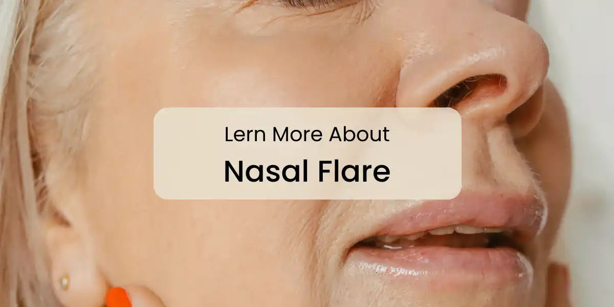 Lern_More_About_Nasal_Flare