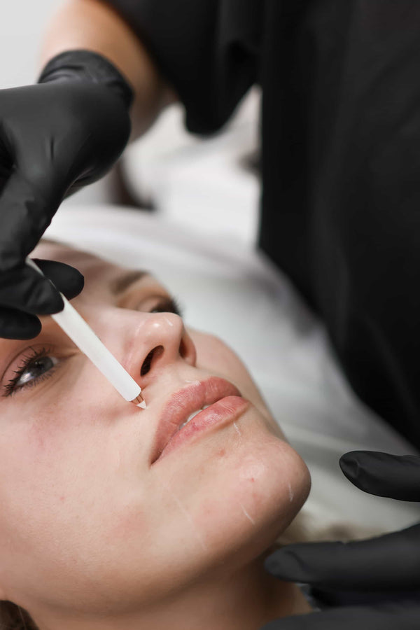 Nose to mouth lines treatment at It’s Me and You Clinic in London, Kingston upon Thames and Surrey – dermal fillers for nasolabial folds, smile line reduction and facial rejuvenation.