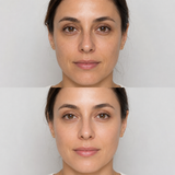 Illustrative NCTF before and after comparison showing brighter, smoother and more hydrated-looking facial skin.
