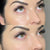 NCTF 135 HA treatment at It’s Me and You Clinic in Kingston upon Thames, Surrey and London – injectable skin booster with hyaluronic acid, vitamins and minerals for hydration and skin rejuvenation.
