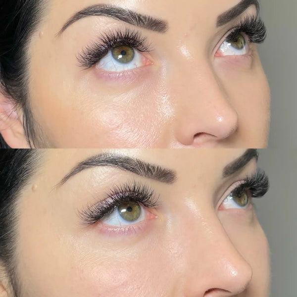 NCTF 135 HA treatment at It’s Me and You Clinic in Kingston upon Thames, Surrey and London – injectable skin booster with hyaluronic acid, vitamins and minerals for hydration and skin rejuvenation.