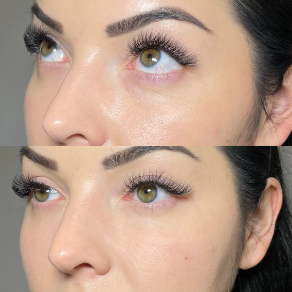 Microneedling Before And After