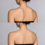Before and after trapezius contouring showing reduced upper trapezius prominence and a softer, slimmer shoulder line.